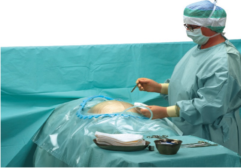 Abdominal cesarean drape