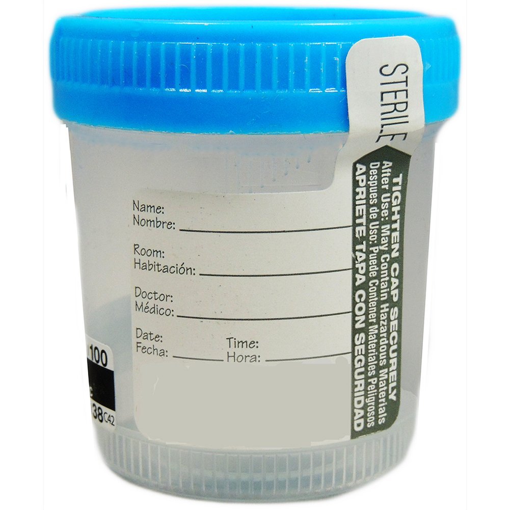 Sterile Specimen Cups with Screw Cap