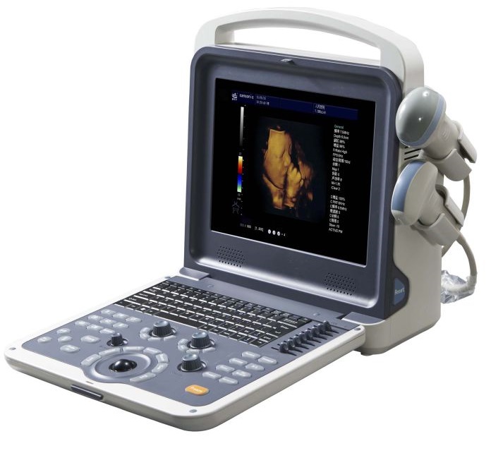 Portable 4D Color Doppler