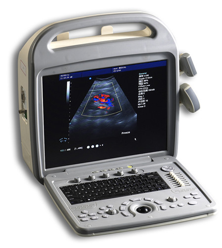 Portable color doppler ultrasound