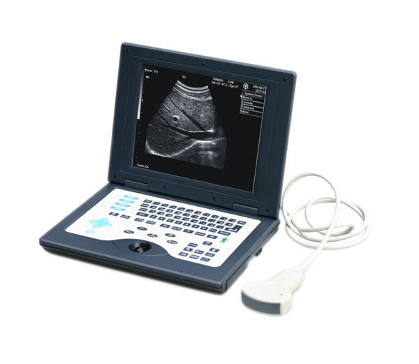 Laptop Ultrasound Scanner